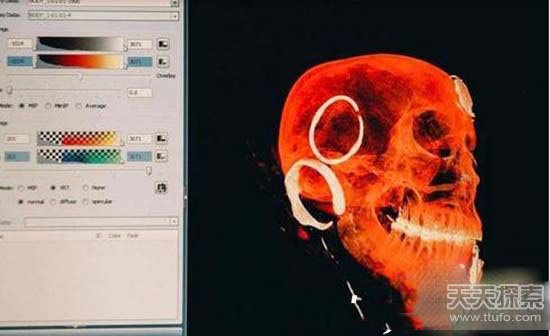 北极洲发掘一具女性木乃伊 其脸部清晰可见！